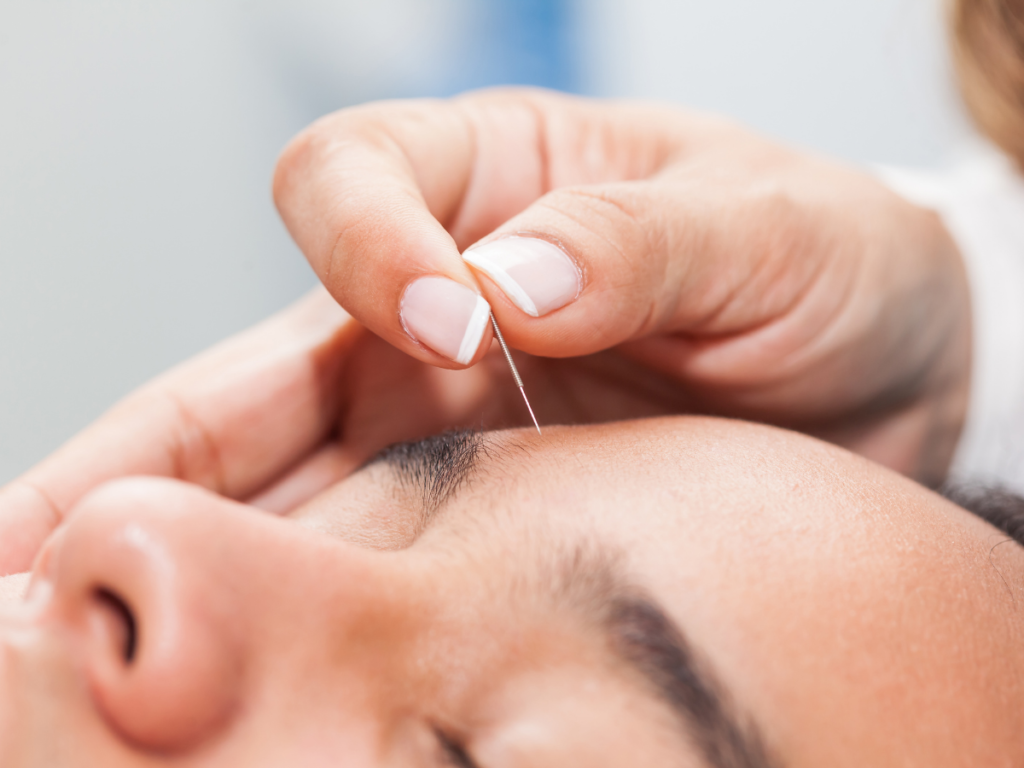 TCM Skin Whitening Secrets & Beauty Tips, TCM skin, TCM for skin, chinese medicine facial, TCM whitening, TCM skin whitening, TCM facial whitening, chinese medicine for dry skin, chinese medicine for skin, face TCM